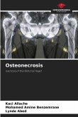 Osteonecrosis