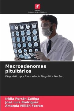 Macroadenomas pituitários - Ferrán Zúñiga, Iridia;Rodríguez, José Luis;Milián Ferrán, Amanda