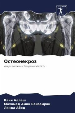 Cover Osteonekroz