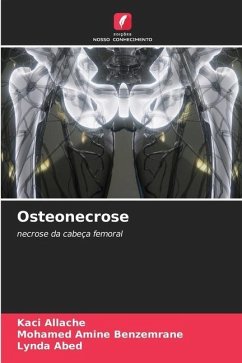 Osteonecrose - Allache, Kaci;Benzemrane, Mohamed Amine;Abed, Lynda