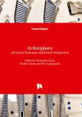 Arthroplasty