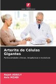 Arterite de Células Gigantes