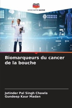 Biomarqueurs du cancer de la bouche - Chawla, Jatinder Pal Singh;Madan, Gundeep Kaur