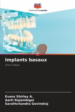 Implants basaux - Shirley A., Evans;RAJAMBIGAI, AARTI;GOVINDRAJ, Sarathchandra