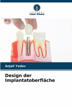 Design der Implantatoberfläche - Yadav, Anjali