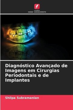 Diagnóstico Avançado de Imagens em Cirurgias Periodontais e de Implantes - Subramanian, Shilpa