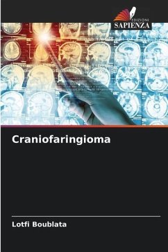 Craniofaringioma - Boublata, Lotfi