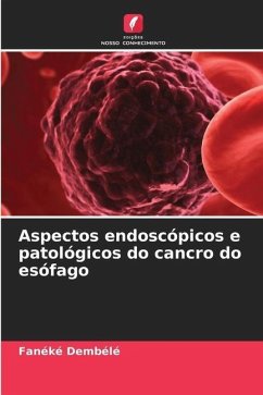 Aspectos endoscópicos e patológicos do cancro do esófago - Dembélé, Fanéké