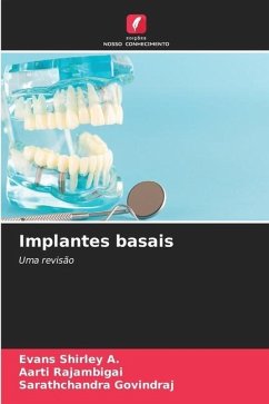 Implantes basais - Shirley A., Evans;RAJAMBIGAI, AARTI;GOVINDRAJ, Sarathchandra