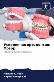 Uskorennaq ortodontiq: Obzor