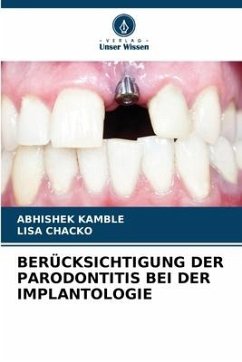 BERÜCKSICHTIGUNG DER PARODONTITIS BEI DER IMPLANTOLOGIE - KAMBLE, ABHISHEK;Chacko, Lisa