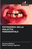 PATOGENESI DELLA MALATTIA PARODONTALE