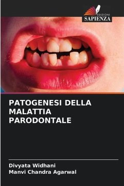 PATOGENESI DELLA MALATTIA PARODONTALE - Widhani, Divyata;Agarwal, Manvi Chandra