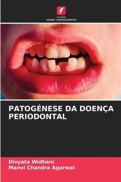 PATOGÉNESE DA DOENÇA PERIODONTAL - Widhani, Divyata;Agarwal, Manvi Chandra