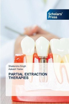 PARTIAL EXTRACTION THERAPIES - Singh, Shailendra;Yadav, Aakash