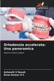 Ortodonzia accelerata: Una panoramica