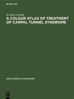 A Colour Atlas of Treatment of Carpal Tunnel Syndrome (eBook, PDF) - Conolly, W. Bruce