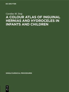 A Colour Atlas of Inguinal Hernias and Hydroceles in Infants and Children (eBook, PDF) - Doig, Caroline M.