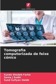 Tomografia computorizada de feixe cónico