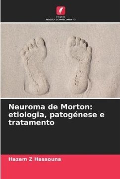 Neuroma de Morton: etiologia, patogénese e tratamento - Hassouna, Hazem Z