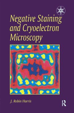 Negative Staining and Cryoelectron Microscopy (eBook, ePUB) - J., R.