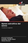 Apnea ostruttiva del sonno