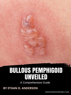 Bullous Pemphigoid Unveiled (eBook, ePUB) - D. Anderson, Ethan