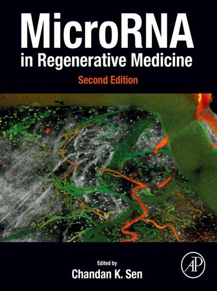 MicroRNA in Regenerative Medicine (eBook, ePUB)