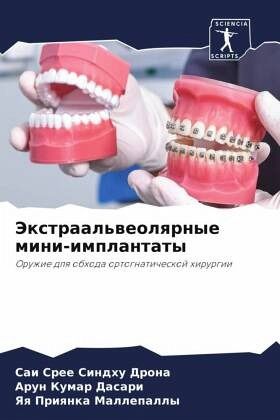 Jextraal'weolqrnye mini-implantaty Jextraal'weolqrnye mini-implantaty