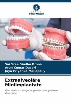 Extraalveoläre Miniimplantate - DRONA, SAI SREE SINDHU;Dasari, Arun Kumar;Mallepally, Jaya Priyanka