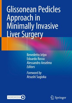 Glissonean Pedicles Approach in Minimally Invasive Liver Surgery