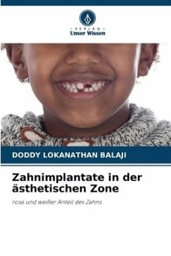 Zahnimplantate in der ästhetischen Zone - Balaji, Doddy Lokanathan