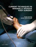 Current Techniques in Minimally Invasive Foot Surgery