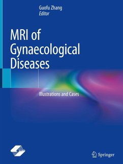 MRI of Gynaecological Diseases