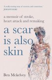 A Scar is Also Skin (eBook, ePUB)