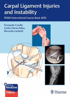 Carpal Ligament Injuries and Instability (eBook, ePUB)