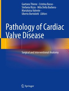 Pathology of Cardiac Valve Disease