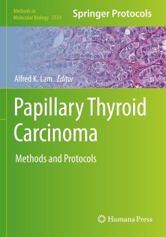 Papillary Thyroid Carcinoma