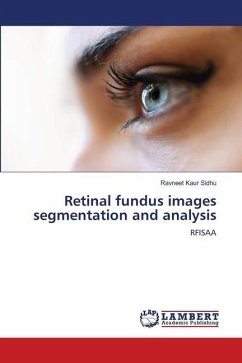Retinal fundus images segmentation and analysis
