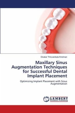Maxillary Sinus Augmentation Techniques for Successful Dental Implant Placement - Thiruvenkata Krishnan, Divakar