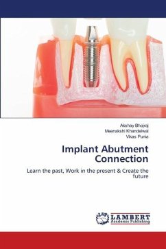 Implant Abutment Connection
