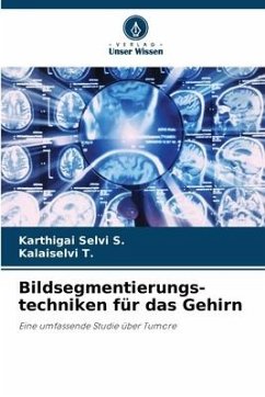 Bildsegmentierungs- techniken für das Gehirn - S., Karthigai Selvi;T., Kalaiselvi