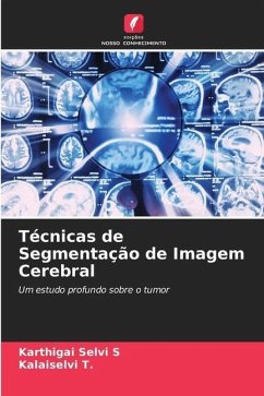 Técnicas de Segmentação de Imagem Cerebral - S, Karthigai Selvi;T., Kalaiselvi