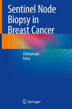 Sentinel Node Biopsy in Breast Cancer