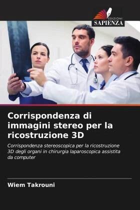 Corrispondenza di immagini stereo per la ricostruzione 3D