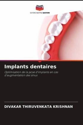 Implants dentaires