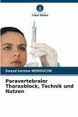 Paravertebraler Thoraxblock, Technik und Nutzen