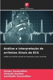 Análise e interpretação de arritmias Sinais de ECG