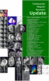 Cardiovascular Magnetic Resonance Update (eBook, ePUB)