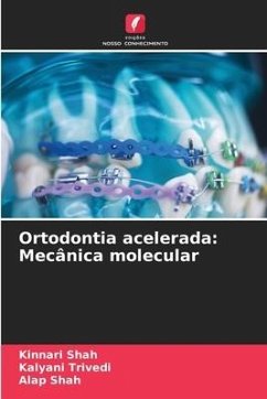 Ortodontia acelerada: Mecânica molecular - Shah, Kinnari;Trivedi, Kalyani;Shah, Alap
